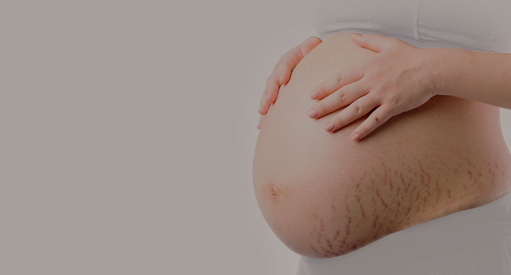 Mamaway彈力妊娠油