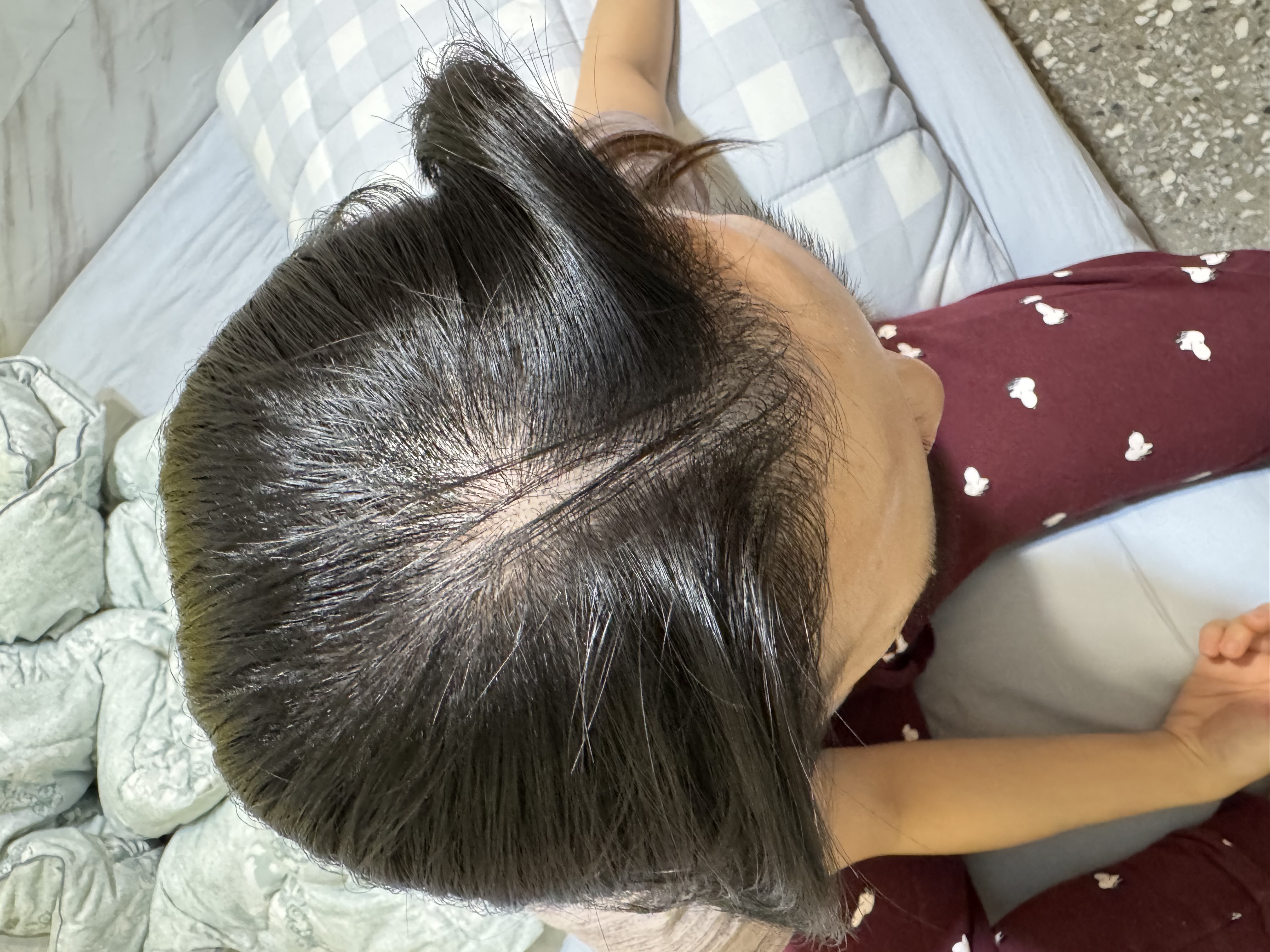 洗髮40天的頭頂